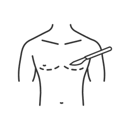 Gynecomastia