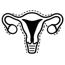 Hysterectomy
