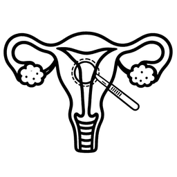 Myomectomy