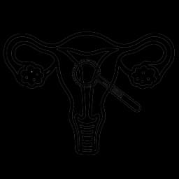 Myomectomy
