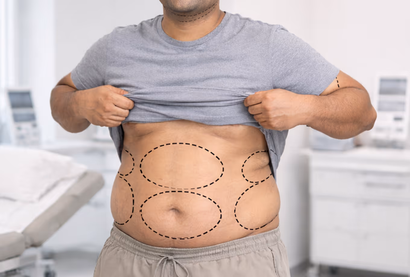Abdomen